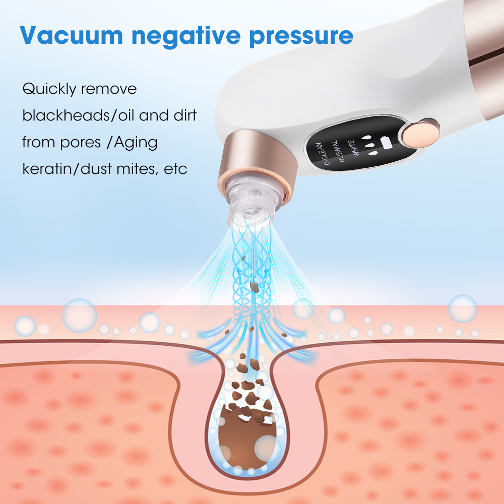 Electric Blackhead Remover, Va - Air Bubble Remover のレビューと価格